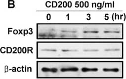 Western Blot CD200R1 Antibody [Unconjugated]