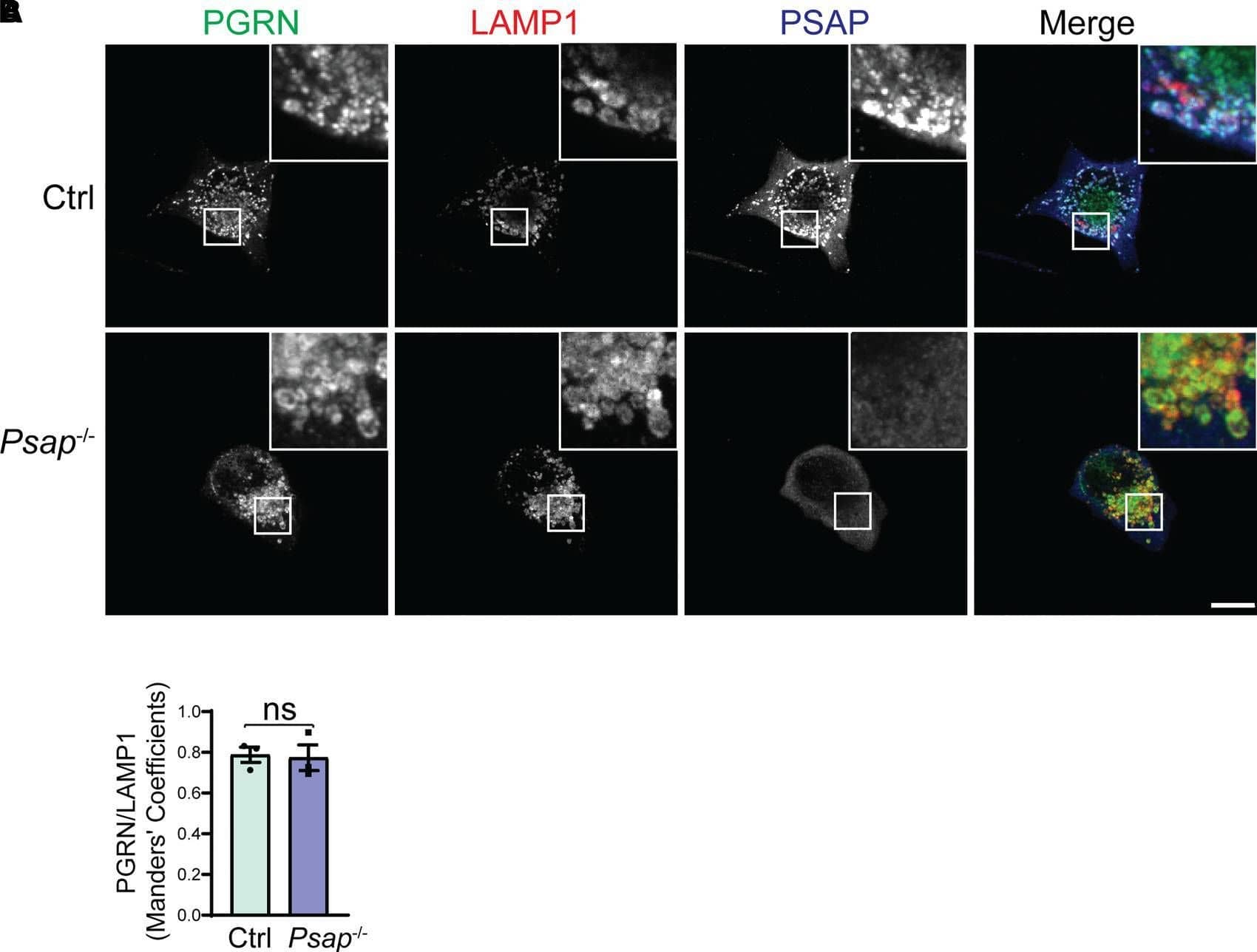 Immunocytochemistry/ Immunofluorescence Progranulin/PGRN Antibody [Unconjugated]