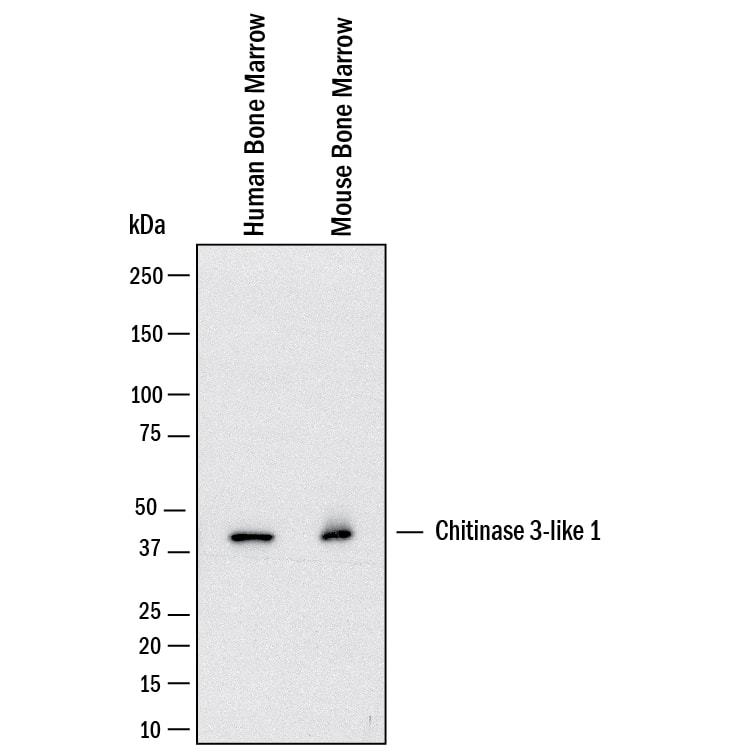Western blot shows lysates of human bone marrow, mouse bone marrow. PVDF membrane was probed with 0.5 µg/mL of Goat Anti-Human Chitinase 3‑like 1/YKL-40 Antigen Affinity-purified Polyclonal Antibody (Catalog # AF2599) followed by HRP-conjugated Anti-Goat IgG Secondary Antibody (Catalog # HAF017). A specific band was detected for Chitinase 3‑like 1/YKL-40 at approximately 40 kDa (as indicated). This experiment was conducted under reducing conditions and using Western Blot Buffer Group 1.