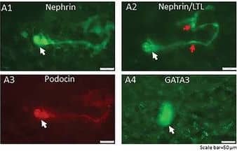 Generation of a self‐organizing de novo nephron from the differentiated Sca1+ Oct4+ monolayer cultures. A) Bright field image of self‐organizing organoid‐like structure from monolayer culture of kidney stem cells. The photo shows glomerulus‐like structure (black arrow), tubule‐like structure (red arrows), and collecting duct‐like structure (green arrow). Scale bar, 100 µm. A1) Glomerulus‐like structure stained with nephrin (white arrow). Scale bar, 50 µm. A2) Glomerulus‐like structure stained with nephrin (white arrow) and proximal tubule‐like structure stained with LTL (red arrows). Scale bar, 50 µm. A3) Glomerulus‐like structure stained with podocin (white arrow). Scale bar, 50 µm. A4) Collecting duct‐like structure stained with GATA3 (white arrow). Scale bar, 50 µm. ,C) Western blot analysis of CD31, nephrin, and podocin expression in undifferentiated and differentiated Sca1+ Oct4+ cells. GAPDH was used as a loading control. Data is representative of three independent experiments. Values represent the mean ± SD (n = 3). p < 0.05 versus control by 2‐tailed Student's t test. Image collected and cropped by CiteAb from the following open publication (//pubmed.ncbi.nlm.nih.gov/35315252), licensed under a CC-BY license. Not internally tested by R&D Systems.