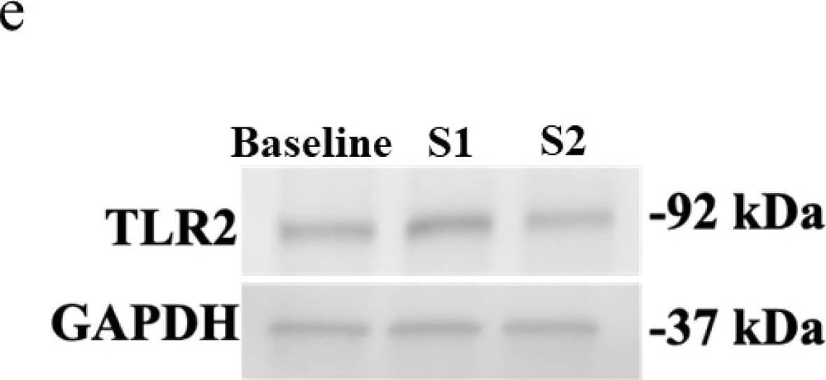 TLR2 expression in airway epithelial cells at baseline and after transfection with S1 or S2. BEAS-2B or A549 cells were cultured in a 24-well plate at 1 × 105 cells per well in a BEGM or F-12K medium (FBS, 10%) for 24 h. TLR2 mRNA and protein levels were assessed using RT-qPCR and immunoblotting, respectively. (a) TLR2 mRNA basal expression in BEAS-2B and A549 cells assessed, n = 3. Data are presented relative to control BEAS-2B cells ( delta  delta Ct) as mean ± SEM. (b) Representative immunoblot and (c) densitometry analysis of basal TLR2 protein expression (92 kDa) in BEAS-2B and A549 cells, n = 3. Values were normalised to those of GAPDH (37 kDa) as a loading control. (d) TLR2 mRNA expression in BEAS-2B cells at baseline and after transfection with S1 or S2 subunit for 24 h, n = 3. The Ct value of TLR2 mRNA was normalised to that of 18S rRNA ( delta Ct). Data are presented relative to the control at baseline ( delta  delta Ct). (e) Representative immunoblot of TLR2 protein and (f) densitometry analysis in BEAS-2B cells at baseline and after transfection with S1 or S2 subunit for 24 h, n = 4. Values were normalised to those of GAPDH as a loading control. Data are presented as mean ± SEM. * p ≤ 0.05, compared with the control group, using unpaired t-test or one-way analysis of variance with Bonferroni post-test. Image collected and cropped by CiteAb from the following open publication (//pubmed.ncbi.nlm.nih.gov/38891051), licensed under a CC-BY license. Not internally tested by R&D Systems.