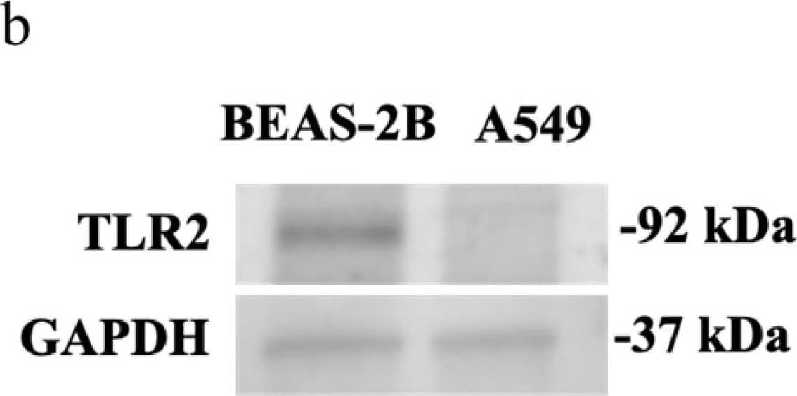 TLR2 expression in airway epithelial cells at baseline and after transfection with S1 or S2. BEAS-2B or A549 cells were cultured in a 24-well plate at 1 × 105 cells per well in a BEGM or F-12K medium (FBS, 10%) for 24 h. TLR2 mRNA and protein levels were assessed using RT-qPCR and immunoblotting, respectively. (a) TLR2 mRNA basal expression in BEAS-2B and A549 cells assessed, n = 3. Data are presented relative to control BEAS-2B cells ( delta  delta Ct) as mean ± SEM. (b) Representative immunoblot and (c) densitometry analysis of basal TLR2 protein expression (92 kDa) in BEAS-2B and A549 cells, n = 3. Values were normalised to those of GAPDH (37 kDa) as a loading control. (d) TLR2 mRNA expression in BEAS-2B cells at baseline and after transfection with S1 or S2 subunit for 24 h, n = 3. The Ct value of TLR2 mRNA was normalised to that of 18S rRNA ( delta Ct). Data are presented relative to the control at baseline ( delta  delta Ct). (e) Representative immunoblot of TLR2 protein and (f) densitometry analysis in BEAS-2B cells at baseline and after transfection with S1 or S2 subunit for 24 h, n = 4. Values were normalised to those of GAPDH as a loading control. Data are presented as mean ± SEM. * p ≤ 0.05, compared with the control group, using unpaired t-test or one-way analysis of variance with Bonferroni post-test. Image collected and cropped by CiteAb from the following open publication (//pubmed.ncbi.nlm.nih.gov/38891051), licensed under a CC-BY license. Not internally tested by R&D Systems.