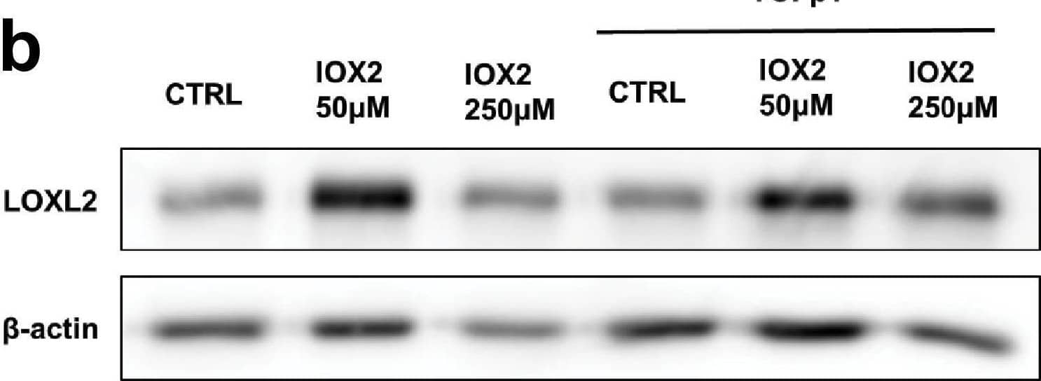 IOX2-mediated HIF pathway activation promotes PLOD2 and LOXL2 expression in the 3D in vitro model of fibrosis. Lung fibroblasts from IPF patients were used in the 3D model of fibrosis in the presence of IOX2 or vehicle control as indicated. Protein expression of (A) HIF1 alpha , PLOD2, and (B) LOXL2 following 2 weeks of culture in the presence or absence of TGF beta 1 with or without IOX2 (50 μM or 250 μM) or vehicle control.  beta -actin loading control. Blots representative of experiments from two separate IPF donors. The full blots are shown in Figure 5—figure supplement 1—source data 1.Figure 5—figure supplement 1—source data 1.Full membrane scans for western blot images for Figure 5—figure supplement 1a, b.Full membrane scans for western blot images for Figure 5—figure supplement 1a, b. Image collected and cropped by CiteAb from the following open publication (//pubmed.ncbi.nlm.nih.gov/35188460), licensed under a CC-BY license. Not internally tested by R&D Systems.