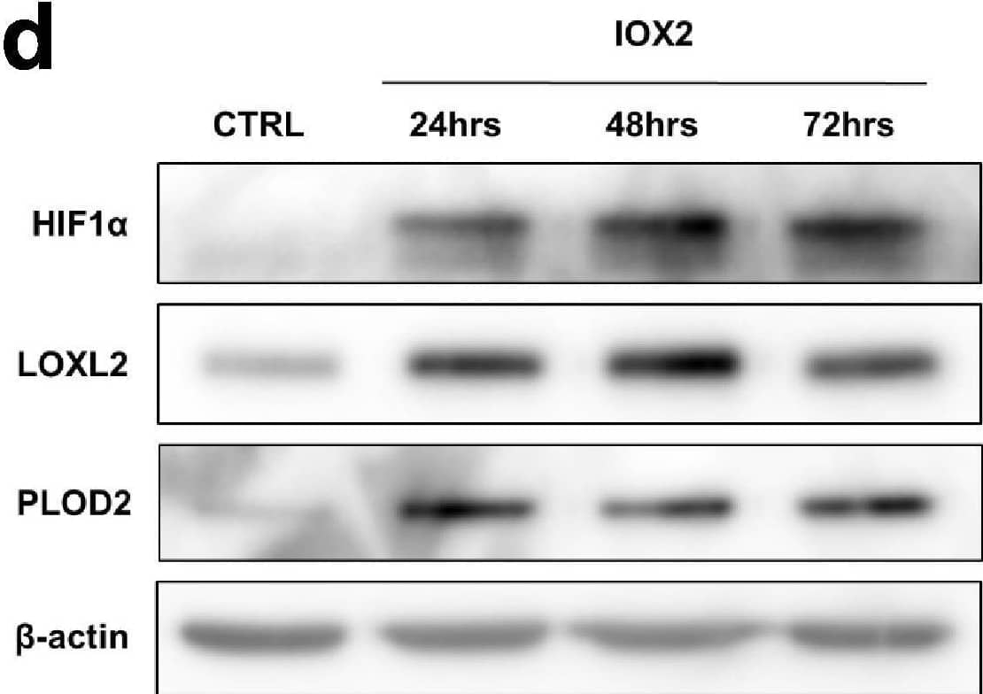 Pro-fibrotic signalling pathways in human lung fibroblasts.(A–C) Healthy lung fibroblasts exposed to control, EGF, TGF beta 1, DMOG, Wnt3 alpha  or Wnt5 alpha  signalling for 24, 48, or 72 hr. n = 3 independent experiments. (A) Protein expression of phospho-ERK, phospho-SMAD2/3, HIF1 alpha , and active  beta -catenin at 24 hr of exposure to conditions.  beta -actin was used as a loading control. The full blots are shown in Figure 2—figure supplement 1—source data 1. (B) LOXL2 and PLOD2 protein levels at 24, 48, or 72 hr of exposure to conditions.  beta -actin was used as a loading control. The full blots are shown in Figure 2—figure supplement 1—source data 1. (C) Expression of COL3A1 in healthy lung fibroblasts exposed to conditions for 24, 48, or 72 hr using the  delta  delta Ct method. Bars indicate geometric means. ****p < 0.0001 by Dunnett’s multiple comparisons test. (D) Protein expression of HIF1 alpha , LOXL2, and PLOD2 in IPF fibroblasts exposed to control media or IOX2 for 24, 48, or 72 hr.  beta -actin was used as a loading control. The full blots are shown in Figure 2—figure supplement 1—source data 1. (E) Fold change in mRNA levels of LOXL2, PLOD2 and the HIF pathway activation marker gene carbonic anhydrase IX/9 (CA9) in MRC5 fibroblasts after incubation in nomoxia (21% O2) or hypoxia (1% O2) for 24 hr.  beta -actin-normalised mRNA levels under nomoxia were used to set the baseline value at unity. Data are mean  ±  s.d. n  =  3 samples per group. ****p < 0.0001 using unpaired t test. Figure 2—figure supplement 1—source data 1.Full membrane scans for western blot images for Figure 2—figure supplement 1a, b, d.Full membrane scans for western blot images for Figure 2—figure supplement 1a, b, d. Image collected and cropped by CiteAb from the following open publication (//pubmed.ncbi.nlm.nih.gov/35188460), licensed under a CC-BY license. Not internally tested by R&D Systems.