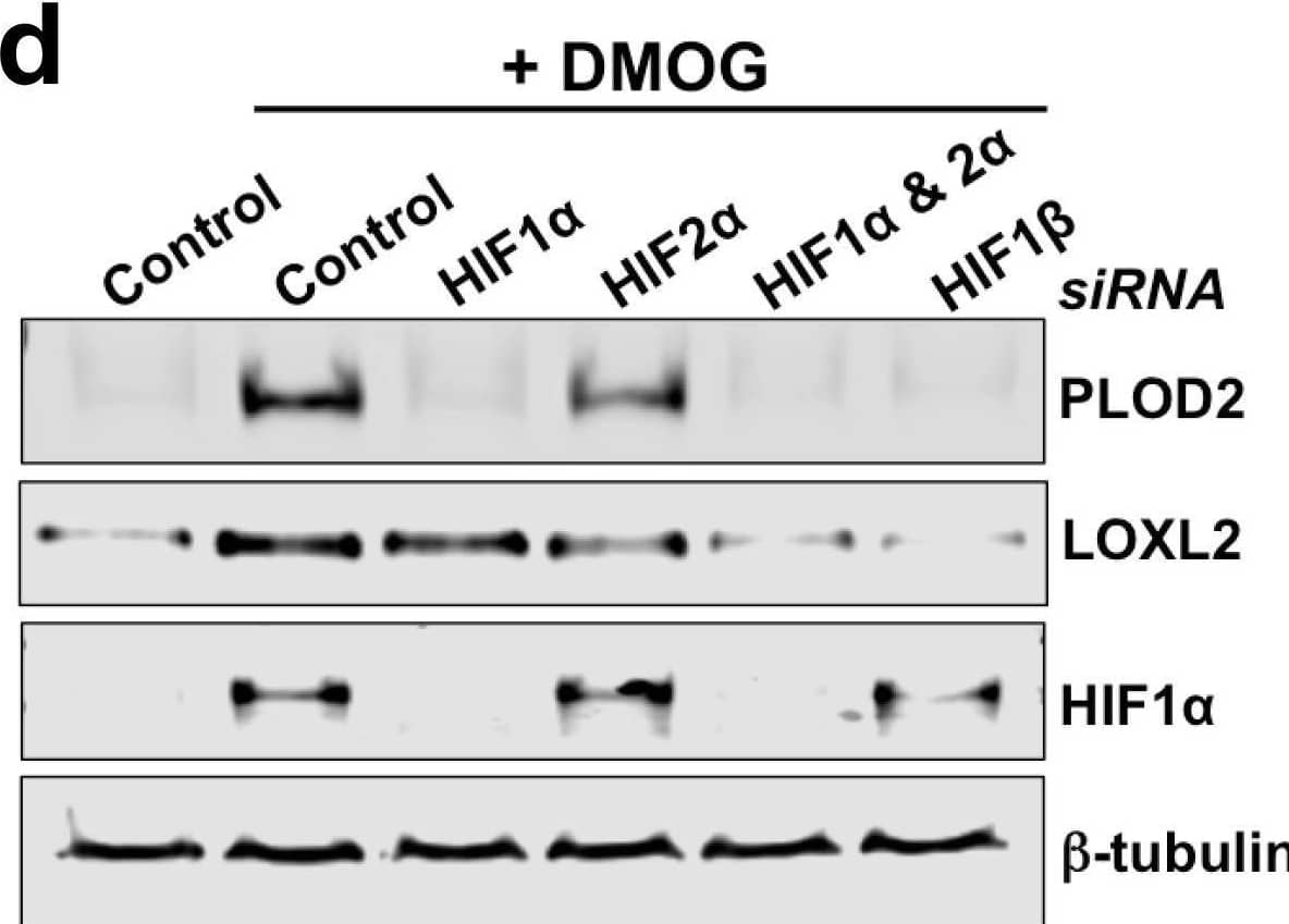 LOXL2 is responsible for increased collagen crosslinking activity in hypoxic EC‐derived exosomes. (A) LOXL2 mRNA expression is decreased in shLOXL2‐transfected EC (shLOXL2) compared to control‐infected EC (shCtrl) (n = 7 ± SD, Student's t‐test). (B) LOXL2 protein expression is decreased in shLOXL2‐transfected EC‐derived exosomes. (C) Analysis of lysyl oxidase activity in exosomes from control (shCtrl) and LOXL2 knock‐down (shLOXL2) (n = 3 ± SD, Student's t‐test). (D) Collagen gels comparing control buffer (Vehicle), and exosomes from control (Exosomes shCtrl) and LOXL2 knock‐down (Exosomes shLOXL2) EC, and (E) quantification of gel contraction after 36 hrs for these conditions (n = 3 ± SD, anova). Collagen crosslinking activity of exosomes from control and LOXL2 knock‐down EC at 20% (Exosomes Control and shLOXL2 Control) and 2% O2 (shLOXL2 Hypoxia) was assessed using (F) the in vitro lysyl oxidase assay and (G and H) the collagen gel contraction assay (n = 3 ± SD, anova). *P  0.05); *p < 0.05; ****p < 0.0001 by Dunnett’s multiple comparisons test. (D) PLOD2, LOXL2 and HIF1 alpha  and  beta -tubulin protein levels in IPF fibroblasts transfected with indicated siRNA followed by treatment of DMSO or DMOG.  beta -tubulin was used as a loading control. The full blots are shown in Figure 3—source data 1.Figure 3—source data 1.Full membrane scans for western blot images for Figure 3d.Full membrane scans for western blot images for Figure 3d. Image collected and cropped by CiteAb from the following open publication (//pubmed.ncbi.nlm.nih.gov/35188460), licensed under a CC-BY license. Not internally tested by R&D Systems.