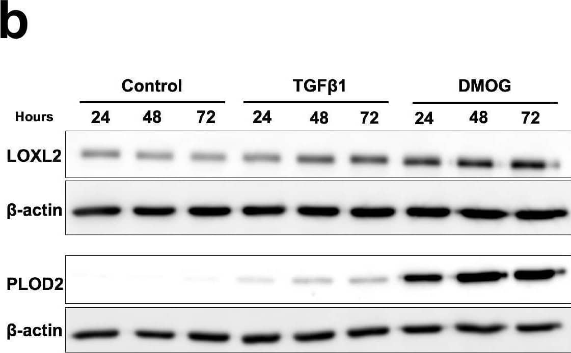 Pro-fibrotic signalling pathways in human lung fibroblasts.(A–C) Healthy lung fibroblasts exposed to control, EGF, TGF beta 1, DMOG, Wnt3 alpha  or Wnt5 alpha  signalling for 24, 48, or 72 hr. n = 3 independent experiments. (A) Protein expression of phospho-ERK, phospho-SMAD2/3, HIF1 alpha , and active  beta -catenin at 24 hr of exposure to conditions.  beta -actin was used as a loading control. The full blots are shown in Figure 2—figure supplement 1—source data 1. (B) LOXL2 and PLOD2 protein levels at 24, 48, or 72 hr of exposure to conditions.  beta -actin was used as a loading control. The full blots are shown in Figure 2—figure supplement 1—source data 1. (C) Expression of COL3A1 in healthy lung fibroblasts exposed to conditions for 24, 48, or 72 hr using the  delta  delta Ct method. Bars indicate geometric means. ****p < 0.0001 by Dunnett’s multiple comparisons test. (D) Protein expression of HIF1 alpha , LOXL2, and PLOD2 in IPF fibroblasts exposed to control media or IOX2 for 24, 48, or 72 hr.  beta -actin was used as a loading control. The full blots are shown in Figure 2—figure supplement 1—source data 1. (E) Fold change in mRNA levels of LOXL2, PLOD2 and the HIF pathway activation marker gene carbonic anhydrase IX/9 (CA9) in MRC5 fibroblasts after incubation in nomoxia (21% O2) or hypoxia (1% O2) for 24 hr.  beta -actin-normalised mRNA levels under nomoxia were used to set the baseline value at unity. Data are mean  ±  s.d. n  =  3 samples per group. ****p < 0.0001 using unpaired t test. Figure 2—figure supplement 1—source data 1.Full membrane scans for western blot images for Figure 2—figure supplement 1a, b, d.Full membrane scans for western blot images for Figure 2—figure supplement 1a, b, d. Image collected and cropped by CiteAb from the following open publication (//pubmed.ncbi.nlm.nih.gov/35188460), licensed under a CC-BY license. Not internally tested by R&D Systems.