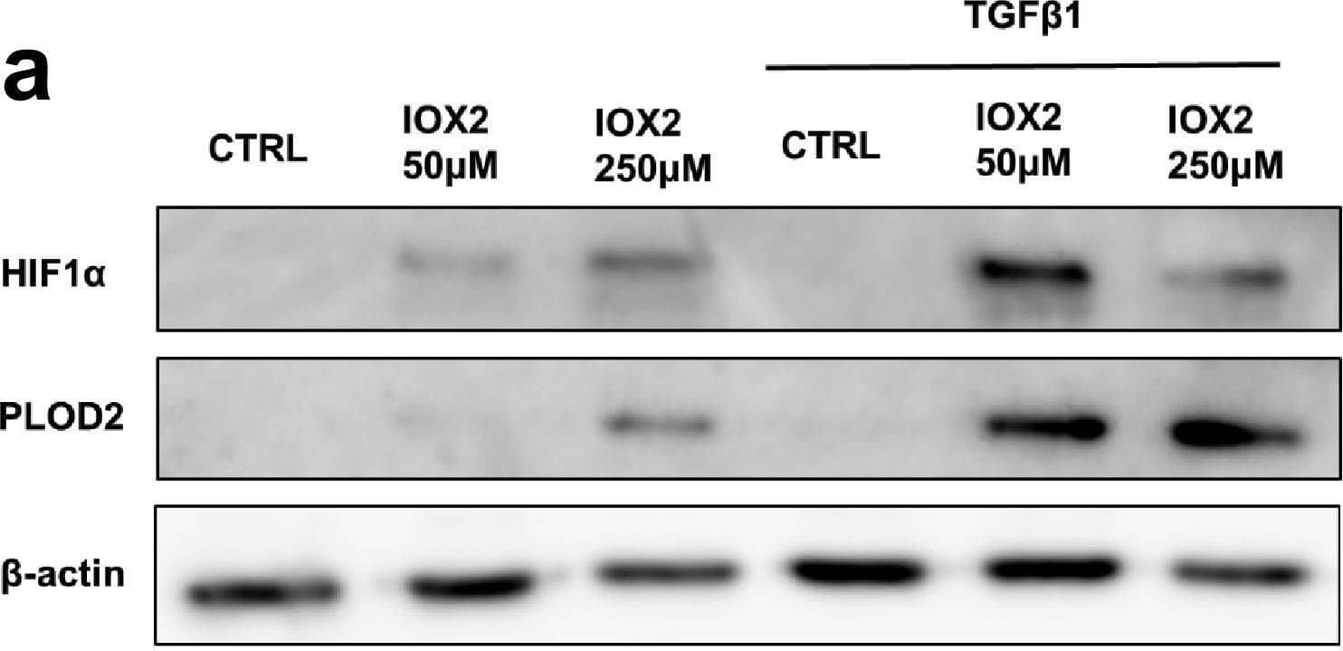 IOX2-mediated HIF pathway activation promotes PLOD2 and LOXL2 expression in the 3D in vitro model of fibrosis. Lung fibroblasts from IPF patients were used in the 3D model of fibrosis in the presence of IOX2 or vehicle control as indicated. Protein expression of (A) HIF1 alpha , PLOD2, and (B) LOXL2 following 2 weeks of culture in the presence or absence of TGF beta 1 with or without IOX2 (50 μM or 250 μM) or vehicle control.  beta -actin loading control. Blots representative of experiments from two separate IPF donors. The full blots are shown in Figure 5—figure supplement 1—source data 1.Figure 5—figure supplement 1—source data 1.Full membrane scans for western blot images for Figure 5—figure supplement 1a, b.Full membrane scans for western blot images for Figure 5—figure supplement 1a, b. Image collected and cropped by CiteAb from the following open publication (//pubmed.ncbi.nlm.nih.gov/35188460), licensed under a CC-BY license. Not internally tested by R&D Systems.