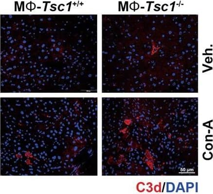 The activation of mTORC1 in KCs enhances complement alternative system.a Expression heatmap of genes of neutrophils chemotaxis or complement activation analyzed by RNA-seq from Tsc1+/+ and Tsc1-/- BMMs (n = 3 each). b Western blotting result was shown the expression of CFB protein in hepatic tissues from mice. c Left, representative co-immunofluorescent staining images for F4/80 with CFB. Scale bar = 50 μm. Right, quantitative determination of F4/80+ and CFB+ cells among groups as indicated, n = 3. d Western blotting assay showing the abundance for TSC1, CFB, and p-S6 in BMMs. e qRT-PCR analysis showing the CFB mRNA abundance in BMMs, n = 3. f Western blotting assay showing the abundance for TSC1, CFB, and p-S6 in KCs. g qRT-PCR analysis showing the CFB mRNA abundance in KCs, n = 3. h Representative immunofluorescent staining images for C3d. Scale bar = 50 μm. i Representative immunostaining images for C5b-9. Scale bar = 50 μm. j Western blotting assay showing the abundance for Rheb and CFB in BMMs. k Western blotting assay showing the abundance for Rheb and CFB in KCs. l Representative co-immunofluorescent staining images for F4/80 with CFB (white arrows). Scale bar = 100 μm. m Quantitative determination of F4/80+ and CFB+ cells among groups as indicated, n = 3. n Representative immunofluorescent staining images for C3d. Scale bar = 100 μm. o Representative immunostaining images for C5b-9 among groups as indicated. Scale bar = 100 μm. *p < 0.05. Image collected and cropped by CiteAb from the following publication (//pubmed.ncbi.nlm.nih.gov/36494334), licensed under a CC-BY license. Not internally tested by R&D Systems.