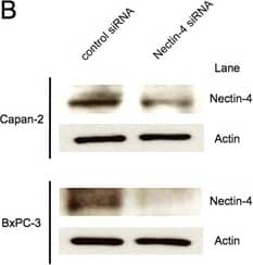 Inhibition of Nectin-4 expression by gene silencing decreases cell proliferation in pancreatic cancer cells. (A,B) Capan-2 and BxPC-3 cells were transfected with Nectin-4 siRNA or control RNA. The relative expression of Nectin-4 was significantly reduced in both cells when transfected with Nectin-4 siRNA for up to 72 hours as determined by quantitative real-time PCR and Western blot analysis (n = 4 of each group). (C) Cell proliferation was significantly inhibited by Nectin-4 gene silencing in both cells after 72 hours incubation as determined by MTS assay (n = 6 of each group). *P < 0.001 versus control siRNA (Student’s t test). Image collected and cropped by CiteAb from the following publication (//jeccr.biomedcentral.com/articles/10.1186/s13046-015-0144-7), licensed under a CC-BY license. Not internally tested by R&D Systems.