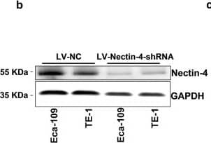 Knockdown expression and over-expression of Nectin-4 in human EC cell lines Eca-109 and TE-1. a The knockdown expression of Nectin-4 at mRNA level by using RNAi approach in human EC lines was confirmed by real-time RT-PCR, and the Nectin-4 mRNA expression level in LV-Nectin-4-shRNA group cells was significantly lower than that in LV-NC group cells (both in Eca-109 and in TE-1, P < 0.0001). b The decreased Nectin-4 protein expression after knockdown in human EC cell lines Eca-109 and TE-1, were confirmed by using western blot method. c The Nectin-4 protein expression level in LV-Nectin-4-shRNA group cells was significantly lower than that in LV-NC group cells (in Eca-109, P < 0.01, and in TE-1, P < 0.001). d The over-expression of Nectin-4 at mRNA level in human EC lines was confirmed by real-time RT-PCR, which showed that the increased Nectin-4 mRNA expression level in LV-Nectin-4-OE group cells compared with LV-Vector-Ctrl group cells (both in Eca-109 and in TE-1, P < 0.0001). e The increased Nectin-4 protein expression in human EC cell lines Eca-109 and TE-1 were confirmed by using western blot method. f The Nectin-4 protein expression level in LV-Nectin-4-OE group cells was significantly higher than that in LV-Vector-Ctrl group cells (in Eca-109, P < 0.01, and in TE-1, P < 0.001) Image collected and cropped by CiteAb from the following publication (//pubmed.ncbi.nlm.nih.gov/31043861), licensed under a CC-BY license. Not internally tested by R&D Systems.