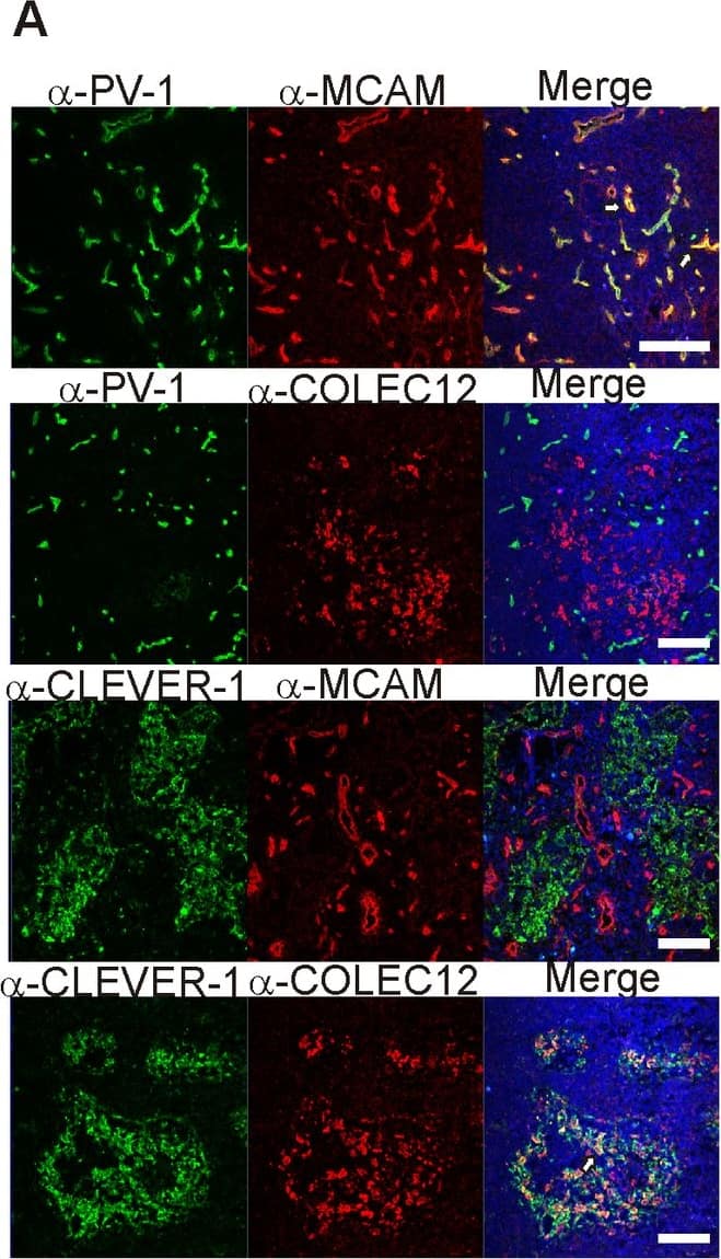 Immunocytochemistry/ Immunofluorescence CL-P1/COLEC12 Antibody