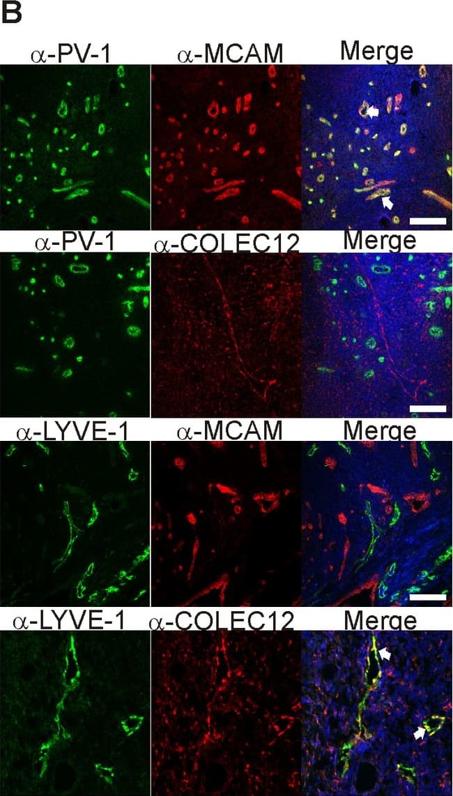 MCAM and COLEC12 are novel BEC- and LEC- specific markers.Two new endothelial markers MCAM and COLEC12 (selected from our analysis of Dataset B) were used to stain (A) normal human lymph nodes together with two established vascular markers PV-1 (for BEC) and CLEVER-1 (for LEC). In addition, (B) chronically inflamed tonsils and (C) specimens from bladder cancer and colorectal cancer were stained with the antibodies against the indicated proteins. LYVE-1 and COLEC12 co-staining was done on colorectal cancer specimens, whereas the other stainings represent bladder cancer. MCAM staining colocalized very well with the established BEC marker PV-1 whereas no colocalization could be detected between MCAM and the established LEC markers LYVE-1 and podoplanin. COLEC12-staining on the other hand showed colocalization with LYVE-1 but not PV-1. White arrows point to areas of colocalization. Nuclear counterstaining was performed with DAPI. Scale bars represent 100 µm. Image collected and cropped by CiteAb from the following publication (https://pubmed.ncbi.nlm.nih.gov/24058540), licensed under a CC-BY license. Not internally tested by R&amp;D Systems.