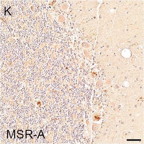 Illustrations and quantification in the cerebellar cortex (Cb) of immunostaining expressed as protein load (%) for the microglial markers TSPO (A–C), Iba1 (D–F), HLA–DR (G–I) and MSR-A (J–L). A significant increase with Braak stage was seen for Iba1 load (P = 0.012). Counterstaining: Haematoxylin. Scale bars = 50μm Image collected and cropped by CiteAb from the following open publication (//pubmed.ncbi.nlm.nih.gov/37580767), licensed under a CC-BY license. Not internally tested by R&D Systems.
