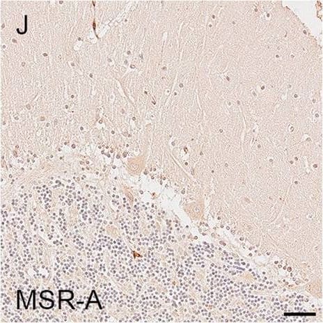 Illustrations and quantification in the cerebellar cortex (Cb) of immunostaining expressed as protein load (%) for the microglial markers TSPO (A–C), Iba1 (D–F), HLA–DR (G–I) and MSR-A (J–L). A significant increase with Braak stage was seen for Iba1 load (P = 0.012). Counterstaining: Haematoxylin. Scale bars = 50μm Image collected and cropped by CiteAb from the following open publication (//pubmed.ncbi.nlm.nih.gov/37580767), licensed under a CC-BY license. Not internally tested by R&D Systems.
