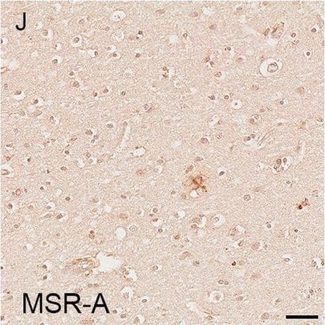 Illustrations and quantification in the temporal lobe (TL) of the immunolabelling expressed as protein load (%) for the microglial markers TSPO (A–C), Iba1 (D–F), HLA–DR (G–I) and MSR-A (J–L). A significant increase with Braak stage was seen for TSPO load (P < 0.0001), while no difference between Braak stages was detected for the other microglial markers. Counterstaining: Haematoxylin. Scale bars = 50μm Image collected and cropped by CiteAb from the following open publication (//pubmed.ncbi.nlm.nih.gov/37580767), licensed under a CC-BY license. Not internally tested by R&D Systems.