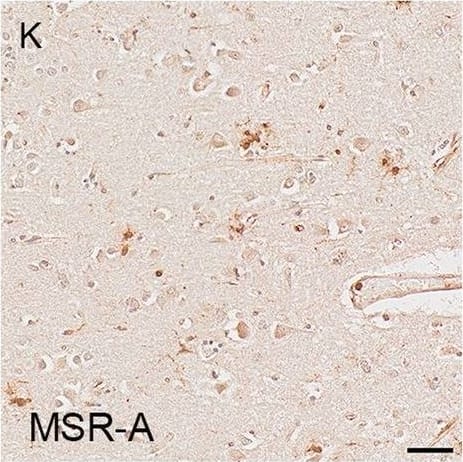 Illustrations and quantification in the temporal lobe (TL) of the immunolabelling expressed as protein load (%) for the microglial markers TSPO (A–C), Iba1 (D–F), HLA–DR (G–I) and MSR-A (J–L). A significant increase with Braak stage was seen for TSPO load (P < 0.0001), while no difference between Braak stages was detected for the other microglial markers. Counterstaining: Haematoxylin. Scale bars = 50μm Image collected and cropped by CiteAb from the following open publication (//pubmed.ncbi.nlm.nih.gov/37580767), licensed under a CC-BY license. Not internally tested by R&D Systems.