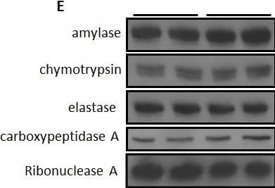 Western Blot Carboxypeptidase A1/CPA1 Antibody