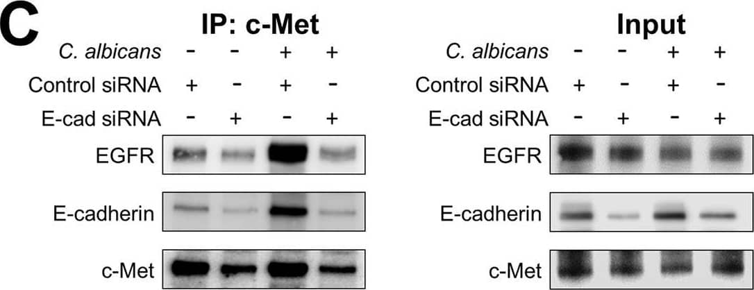 C. albicans induces c-Met, EGFR, and E-cadherin to form a multiprotein complex.(A-C) Proximity ligation assay showing the interaction of c-Met with E-cadherin, EGFR with E-cadherin, and c-Met with EGFR in oral epithelial cells with and without 20-min infection with C. albicans. Confocal microscopic images (A). Scale bar 10 μm. Signal counts (B). Proximity ligation assay showing the interaction of c-Met with E-cadherin, EGFR with E-cadherin, and c-Met with EGFR in oral epithelial cells with and without 20-min infection with C. albicans. (A) Confocal microscopic images. Scale bar 10 μm. (B) Signal counts. (C-E) Co-immunoprecipitation experiments in oral epithelial cells transfected with control or E-cadherin (E-cad) siRNA and then infected with C. albicans for 20 min. (C) Representative immunoblots of proteins obtained by immunoprecipitation with an anti-c-Met antibody. (D and E) Densitometric analysis of 5 immunoblots. Results are mean ± SD. **p < 0.01, ***p < 0.001, ****p < 0.0001, ns; not significant (two-tailed Student’s t test [B] or one-way ANOVA with Sidak’s multiple comparisons test [D and E]). Image collected and cropped by CiteAb from the following open publication (//pubmed.ncbi.nlm.nih.gov/37611070), licensed under a CC-BY license. Not internally tested by R&D Systems.