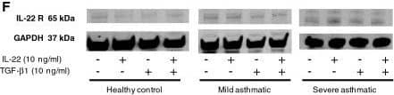 IL-22 and IL-22 receptor expression levels increase in the airways of asthmatic subjects. (A-D) Bronchial biopsies were obtained from healthy controls, mild asthmatics and severe asthmatics and stained (A, negative control) for IL-22 expression (in brown) by immunohistochemistry. Scale bar 50 μm. (E) The number of IL-22 positive cells was determined per mm2 of biopsy tissue. n=5 per group, *p<0.05 vs. healthy control. (F) Primary bronchial epithelial cells were obtained from healthy controls, mild asthmatics and severe asthmatics and assessed for IL-22 receptor expression by Western blot. Cells were allowed to grow to confluence, serum starved overnight and stimulated with IL-22, TGF-beta 1 (10 ng/mL each) or both cytokines for 5 days before Western blot analysis. (G) Expression levels of the IL-22 receptor in unstimulated cells were quantified relative to GAPDH expression. n=5 per group, *p<0.05 vs. healthy control. Image collected and cropped by CiteAb from the following publication (//respiratory-research.biomedcentral.com/articles/10.1186/1465-9921-14-118), licensed under a CC-BY license. Not internally tested by R&D Systems.