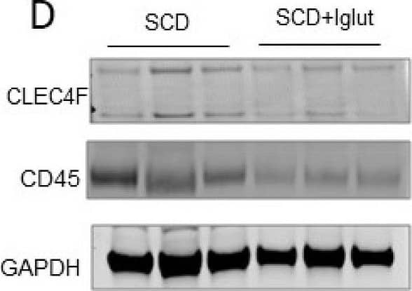 L-glutamine treatment does not ameliorate ischemic injury in SCD mouse liver. (A) Quantitative liver intravital (qLIM) imaging of three different fields of view of SCD mice at baseline and post-L-glutamine administration injected with TXR-dextran. Dotted circle shows loss of blood flow in SCD liver which was comparable in L-glutamine-treated SCD mouse liver. (B) Quantification of the total area (%) of liver with loss of blood flow in SCD mice at baseline and post-L-glutamine treatment. (C) Representative IF images show enhanced CLEC4F and F4/80 expression in SCD liver which was not seen after L-glutamine administration. (D) Western Blot for CLEC4F and CD45 antibodies exhibits increased expression in the liver of SCD mice compared to L-glutamine-treated SCD mouse liver. (E) qRT-PCR analysis exhibits reduced mRNA expression of markers of inflammatory cells (including F4/80, Cd45, CLEC4F, and IL1 beta ) in L-glutamine-treated SCD liver compared to SCD liver at baseline. * denotes p < 0.05, NS, Not significant. Image collected and cropped by CiteAb from the following open publication (//pubmed.ncbi.nlm.nih.gov/37760853), licensed under a CC-BY license. Not internally tested by R&D Systems.