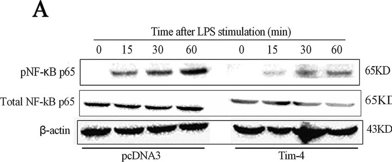 Western Blot TIM-4 Antibody [Unconjugated]