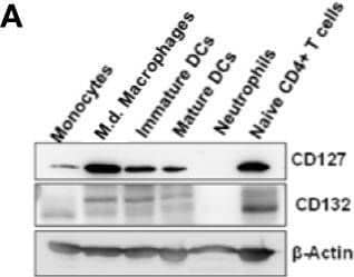 Western Blot Common gamma Chain/IL-2 R gamma Antibody [Unconjugated]