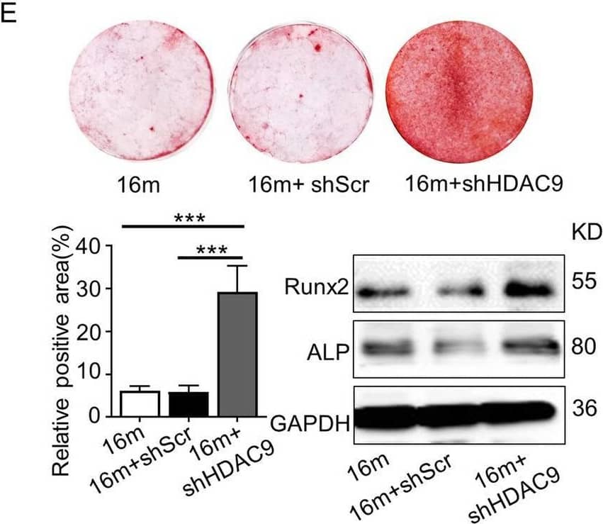 Inhibition of HDAC9 improved the lineage differentiation of endogenous BMMSCs ex vivo. The BMMSCs harvested from the mice from the control, shScr-treated, & shHDAC9-treated groups 4 weeks after bone intrainjection. e Alizarin Red staining was performed, & osteogenesis-related proteins detected in BMMSCs from the three group. Image collected & cropped by CiteAb from the following open publication (//pubmed.ncbi.nlm.nih.gov/32620134), licensed under a CC-BY license. Not internally tested by R&D Systems.