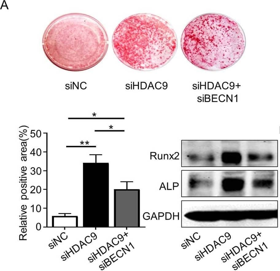 Inhibition of autophagy blocked the ability of HDAC9 siRNA to rebalance BMMSC differentiation. To investigate the HDAC9-autophagy axis regulating BMMSC function, BMMSCs were respectively transfected with Nc siRNA and HDAC9 siRNA or co-transfected with HDAC9 siRNA and BECN1 siRNA. a Alizarin Red staining was performed, and osteogenesis-related proteins were analyzed in aged BMMSCs from above three groups. b Oil Red O staining was performed, and adipogenesis-related proteins were analyzed in three groups of cells described above. Scale bars = 100 μm. The data are presented as the means ± SD of each independent experiment performed in triplicate. *P < 0.05, **P < 0.01, one-way analysis of variance (ANOVA) Image collected and cropped by CiteAb from the following open publication (//pubmed.ncbi.nlm.nih.gov/32620134), licensed under a CC-BY license. Not internally tested by R&D Systems.