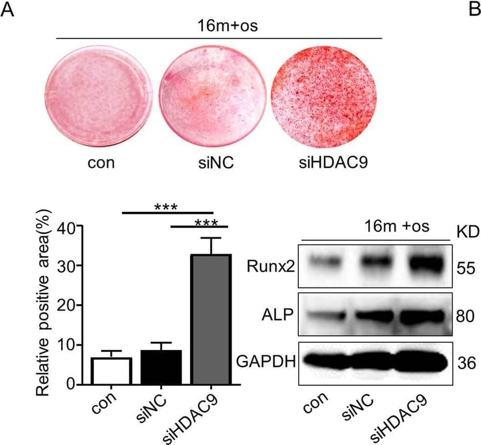 Downregulation of HDAC9 rescued lineage differentiation imbalance and ameliorated senescence in aged BMMSCs. a Alizarin Red staining was performed, and osteogenesis-related proteins were detected by western blotting in aged BMMSCs transfected with HDAC9 siRNA. b Oil Red O staining was performed, and adipogenesis-related proteins were detected by western blotting in aged BMMSCs transfected with HDAC9 siRNA. c Alizarin Red staining was performed, and osteogenic-related proteins were detected by western blotting in young BMMSCs and young BMMSCs transfected with HDAC9 siRNA. d Oil Red O staining was performed, and adipogenic-related proteins were detected by western blotting in young BMMSCs and young BMMSCs transfected with HDAC9 siRNA. e, f Expressions of the senescence-related proteins p53 and p-p53 in BMMSCs cultured in vitro from aged mice (e) and young mice (f) were examined by western blotting. The data are presented as the means ± SD of each independent experiment performed in triplicate. *P < 0.05, **P < 0.01, ***P < 0.001, one-way analysis of variance (ANOVA) Image collected and cropped by CiteAb from the following open publication (//pubmed.ncbi.nlm.nih.gov/32620134), licensed under a CC-BY license. Not internally tested by R&D Systems.