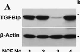 Western Blot Beta Ig-h3/TGFBI Antibody