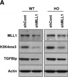 Western Blot Beta Ig-h3/TGFBI Antibody
