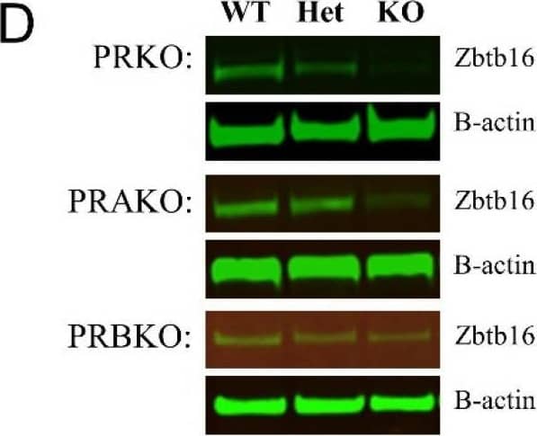 Western Blot PLZF Antibody [Unconjugated]