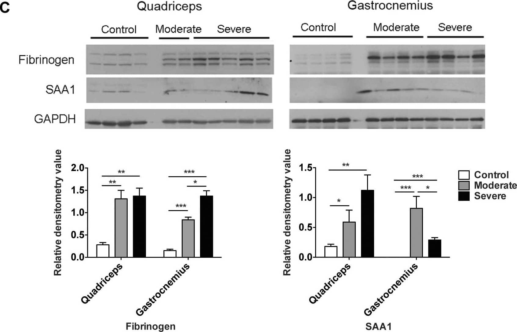 Robust expression of acute phase response proteins in skeletal muscle versus liver in C26 cachexia.A. Western blotting and quantitation of fibrinogen levels in control and C26 quadriceps and liver. Data (mean ± SEM) are expressed as relative densitometry value. **P<0.01, ***P<0.001. B, Western blotting analysis of fibrinogen standard proteins and quadriceps and liver extracts for control, CHO-IL6 injected nude mice and C26 injected CD2F1 mice. Quantitation was performed on the band indicated by the arrow. Data (means ± SEM) are expressed as ng fibrinogen / µg protein. *P<0.05, **P<0.01, ***P<0.001. C, Western blotting analysis demonstrates significantly increased fibrinogen and SAA1 protein levels in quadriceps and gastrocnemius in moderate and severe C26 cachexia. *P<0.05, **P<0.01, ***P<0.001. Image collected and cropped by CiteAb from the following open publication (//pubmed.ncbi.nlm.nih.gov/21799891), licensed under a CC-BY license. Not internally tested by R&D Systems.