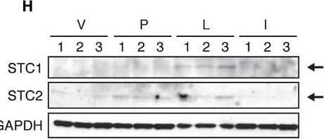 Lactation inhibits the oncogenic effect of PAPP‐AAIncidence of spontaneous mammary tumor formation in PAPP‐A females relative to the duration of lactation. Long lactation of > 3 weeks ranges from 21 to 24 days, with an average of 21.25 days, while short lactation of < 2 weeks ranges from 0 to 13 days, with an average of 1.076 days. Fisher's exact test: P = 0.0170.B–DGrowth rate of ctl and p‐a xenografts injected in fat pad of actively involuting mammary glands without any prior lactation (‐Inv.), of actively lactating (‐Lac.), and of actively involuting mammary glands following 2 weeks of prior lactation (‐Lac.+Inv.), (n = 3 mice, 6 tumors total, mean ± SD). Unpaired t‐test (two‐tailed) was applied to calculate statistical significance at the end point. **P = 0.0027 for (B), P = 0.4359 for (C), and P = 0.3066 for (D).EWhole‐mount analyses of involuting mammary glands (n = 12 mice; three mice per time point) at days 1, 3, 6, and 12 of involution in NT and PAPP‐A females, scale bar: 1 mm.FH&E sections of corresponding mammary glands from (E), scale bar: 100 μm.GImmunoblot of mammary glands during involution in NT and PAPP‐A females. Immunoblot for STC1 and STC2 from mammary gland extracts of virgin (V), at pregnancy (P), at lactation (L), or at involution (I) performed in triplicate mice per group. Quantification of immunoblot for STC1 or STC2 from (H). Error bars are mean ± SD. Left panel (STC1) *P = 0.0148 (V versus I), *P = 0.0293 (P versus I), **P = 0.0021 (L versus I). Right panel (STC2) *P = 0.0248 (V versus L), **P =  0.0079 (L versus I).Immunoblot of rIGFBP‐5 following proteolysis assay using NT or PAPP‐A extracts from V, P, L or I mammary glands. Source data are available online for this figure. Image collected and cropped by CiteAb from the following open publication (//pubmed.ncbi.nlm.nih.gov/26951623), licensed under a CC-BY license. Not internally tested by R&D Systems.