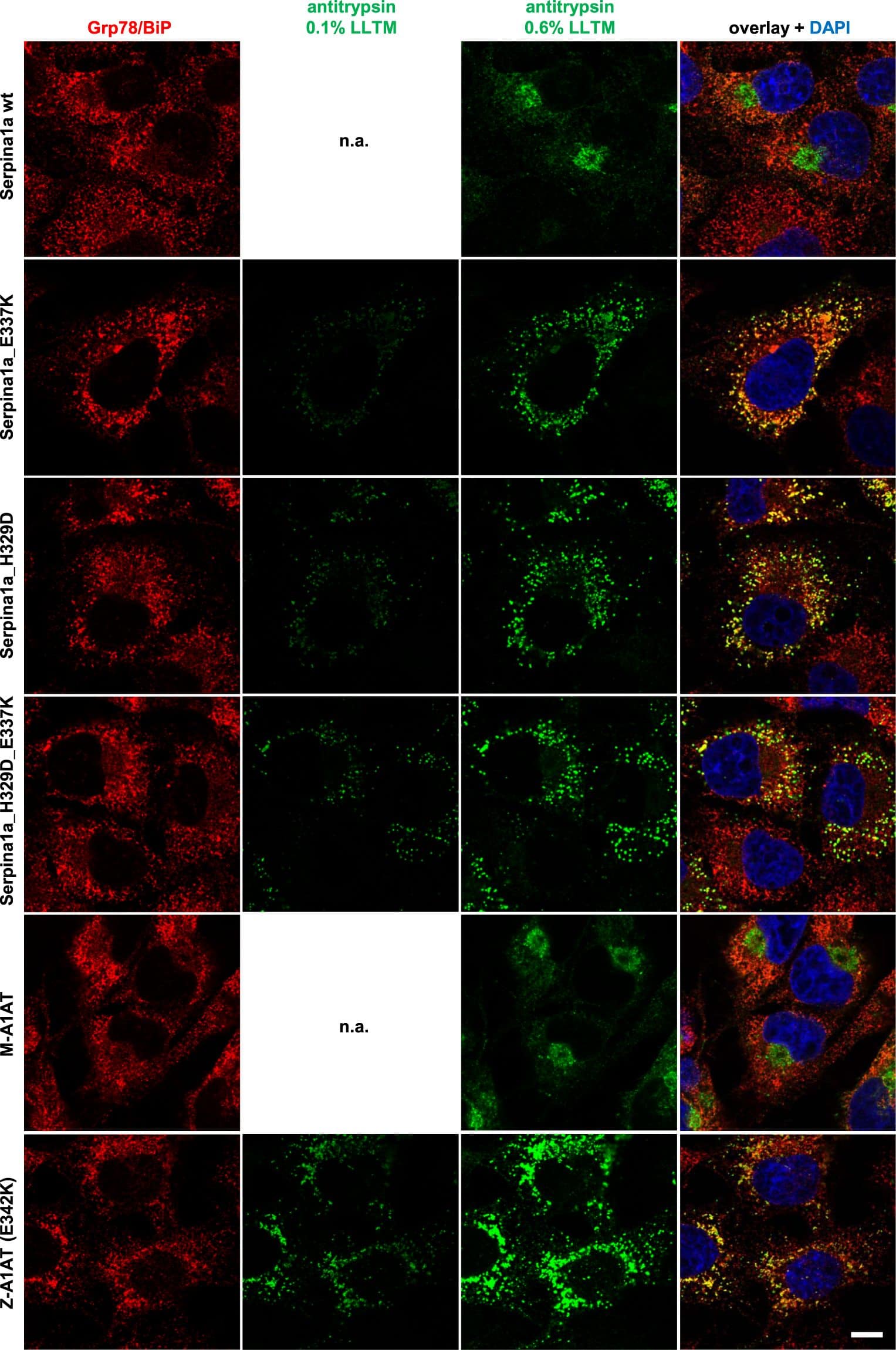 Serpina1a mutants imitate intracellular distribution of human Z-A1AT. Confocal laser immunofluorescence analysis of COS-7 cells expressing wild type (wt; top row), E337K, H329D or H329D_E337K double mutant Serpina1a (second to fourth row), compared to cells overexpressing normal human M-A1AT or E342K Z-A1AT (fifth and sixth row). Mouse Serpina1a and human A1AT were stained with Alexa Fluor 568 secondary antibody (green) and exposed to 0.6% laser light transmission (LLTM). Mutant-expressing cells were additionally exposed to 0.1% LLTM, as the very strong signal resulted in over-saturation at 0.6%. ER-marker Grp78/BiP was stained with Alexa Fluor 647 secondary antibody (red) and cell nucleus was stained using DAPI (blue). Scale bar: 10 µm. Image collected and cropped by CiteAb from the following publication (//pubmed.ncbi.nlm.nih.gov/31097772), licensed under a CC-BY license. Not internally tested by R&D Systems.