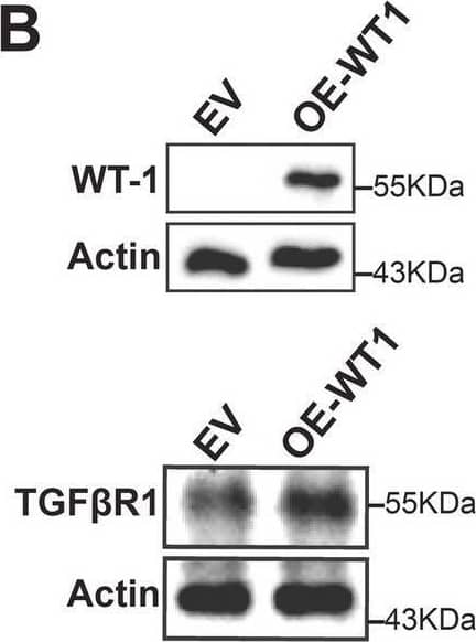 WT1 regulates the STAT1/3 pathway in CAFs. A Protein levels of WT1, STAT1, STAT3, PD-L1 and the TGF beta  receptor were determined in WT1 knockdown (A) and WT1 overexpressed (B) CAFs by Western blotting. Actin was used as a loading control. IDO release was determined by ELISA. RNA levels of PD-L1 was determined by qRT-PCR. TBP was used as a loading control. Representative experiment is shown of n = 3–5 biological replicates. Data represents mean ± SEM; * P < 0.05, ** P < 0.01, *** P < 0.001, and **** P < 0.0001 Image collected and cropped by CiteAb from the following open publication (//pubmed.ncbi.nlm.nih.gov/40598415), licensed under a CC-BY license. Not internally tested by R&D Systems.