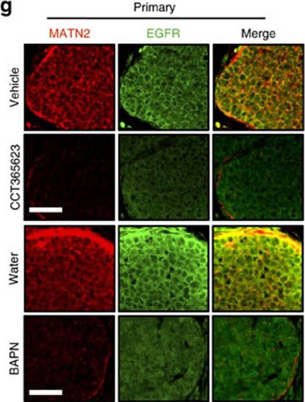 Chemical inhibition of LOX blocks tumour growth and metastasis.(a) Tumour growth in vehicle or CCT365623-treated MMTV-PyMT mice. Data are represented as mean±s.d. from six mice per group. **P<0.01, Student's t-test. (b) H&E stained lungs from vehicle or CCT365623 treated MMTV-PyMT mice. Scale bar, 100 μm. (c) Quantification of lung metastasis in mice from a. All data are presented as mean±range, n=6 animals. **P<0.05, Mann–Whitney analysis. (d) Tumour growth in water or BAPN-treated MMTV-PyMT mice. Data are represented as mean±s.d. from seven mice per group. **P<0.01, Student's t-test. (e) H&E stained lungs from water or BAPN-treated MMTV-PyMT mice. Scale bar, 100 μm. (f) Quantification of lung metastasis in mice from d. All data are presented as mean±range, n=7 animals. **P<0.05, Mann–Whitney analysis. (g,h) Confocal photomicrographs of MATN2 (red) and EGFR (green) staining in primary and metastatic tumours from vehicle, CCT365623, water or BAPN-treated MMTV-PyMT mice. Scale bars, 20 μm. (i–l) Quantification of MATN2 and EGFR staining in primary or metastatic tumours from g and h. All data are represented as mean±s.e.m. Samples from six vehicle or CCT365623 and seven water or BAPN-treated mice were analysed. **P<0.01, Student's t-test. Image collected and cropped by CiteAb from the following publication (//www.nature.com/articles/ncomms14909), licensed under a CC-BY license. Not internally tested by R&D Systems.