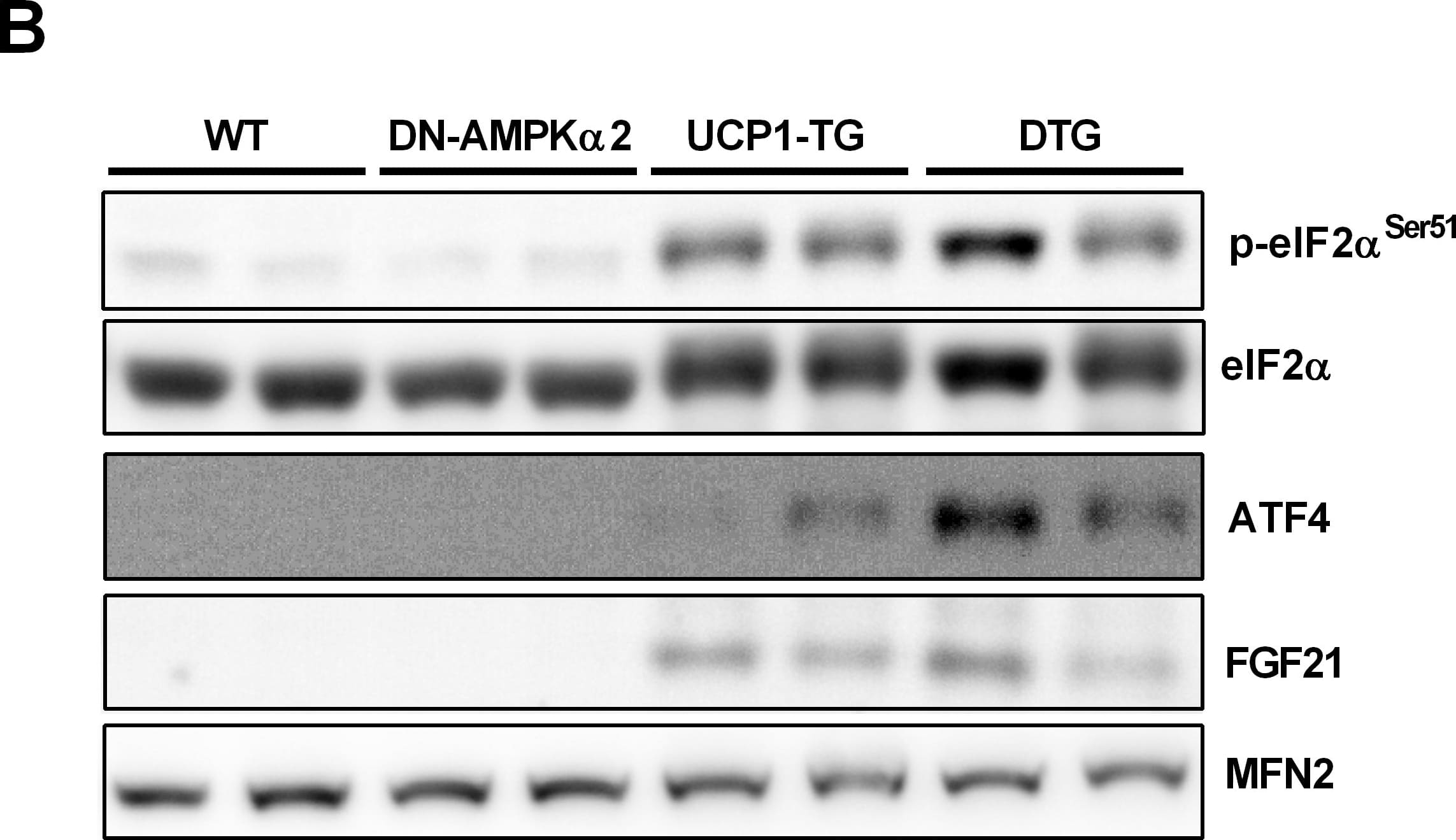 Increased cellular stress response in muscle of DTG mice.(A) Gene expression analysis of FGF21 in Quadriceps muscle by quantitative RT-PCR (n = 8 per group) and (B) FGF21 plasma concentration of 12-wk-old WT, DN-AMPK alpha 2, UCP1-TG and DTG mice (n = 9–10 per group). (B) Representative western blots of proteins involved in integrated stress response and FGF21 induction and (C) of cellular stress response markers HSP25 and HSP70 in Quadriceps muscle from 12-wk-old WT, DN-AMPK alpha 2, UCP1-TG and DTG mice, Mitofusin-2 (MFN2) was used as a loading control (n = 2 out of 6–8 analyzed per group). Means with different letters are significantly different (1way ANOVA and Bonferroni's multiple comparisons test, p<0.05). Image collected and cropped by CiteAb from the following publication (//pubmed.ncbi.nlm.nih.gov/24732703), licensed under a CC-BY license. Not internally tested by R&D Systems.