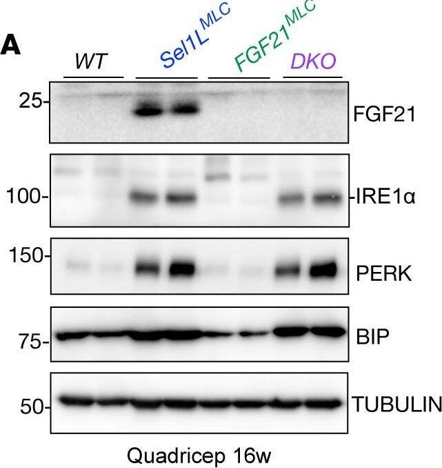 FGF21 links SEL1L-HRD1 ERAD in skeletal muscle to systemic metabolic regulation.(A) Representative Western blot of ER homeostasis proteins and FGF21 in WT, Sel1LMLC (SKO), FGF21MLC (FKO), and Sel1L/Fgf21 double knockout (DKO) mice (n = 4 mice per genotype). (B) Serum measurement of FGF21 from male and female mice at 16–20 weeks old (n = 5–7 per genotype). (C) Body length of 16-week-old mice (n = 7–20 for males, n = 7–14 for females). (D) Weekly body mass of male and female mice (n = 6–44 per genotype/time point for males, n = 5–45 per genotype/time point for females). Statistical comparison made between Sel1LMLC and DKO mice. (E) Muscle mass–to–body mass ratios in male mice (n = 4–18 per genotype). Comparisons were made between indicated groups. FKO muscle was not statistically different from WT. (F) Representative H&E-stained images of inguinal white adipose tissue (n = 3 mice per genotype). (G) Representative Western blot of UCP1 in WT, Sel1LMLC, FGF21MLC, and DKO mice (n = 4 mice per genotype). Data presented as mean ± SEM. NS, P > 0.05; *P < 0.05; **P < 0.01; ****P < 0.0001 determined by 1-way ANOVA with Tukey’s multiple-comparison test (B, C, and E) or mixed-effects analysis (repeated-measure ANOVA) with Tukey’s multiple-comparison test (D). Image collected and cropped by CiteAb from the following open publication (//pubmed.ncbi.nlm.nih.gov/37535424), licensed under a CC-BY license. Not internally tested by R&D Systems.