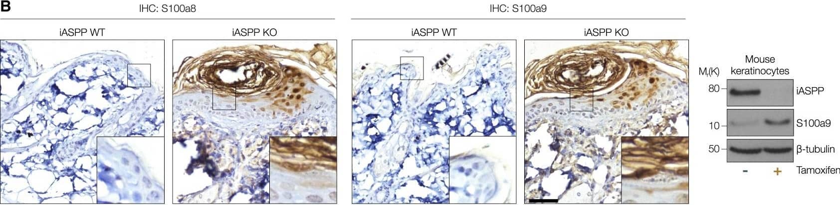 iASPP deficient keratinocytes induce pro-inflammatory gene expression in vitro and attract macrophages in vivo(A) qPCR analysis of mRNA expression levels of inflammatory genes (and iASPP gene Ppp1r13l) in iASPP WT and KO primary keratinocytes at 0, 1, and 6 h after treatment with TNF-alpha . Values are mean + SD. ∗p < 0.05, ∗∗p < 0.01, ∗∗∗p < 0.001, ∗∗∗∗p < 0.0001; n = 3 biological replicates.(B) Left, IHC staining of S100a8 and S100a9 in untreated skin sections from iASPP WT and KO mice (adjacent sections). Scale bar, 50 μm. Right, IB of iASPP and S100a9 expression levels in iASPP WT (−tamoxifen) and KO (+tamoxifen) primary keratinocytes.(C) H&E analysis of acetone- or TPA-treated skin sections from iASPP WT and KO mice. Scale bar, 50 μm. Histograms below show epidermal thickness in the same samples. Values are mean ± SD. n = 3 (WT) and n = 4 (KO) mice in acetone cohort; n = 4 (WT), n = 3 (KO) mice in TPA cohort.(D) IHC staining of F4/80-positive macrophages in acetone- or TPA-treated skin sections from iASPP WT and KO mice. Scale bar, 50 μm. Histograms below show quantification of the same samples. Values are mean + SD. Same cohort as in (C).See STAR Methods for p calculations for (A), (C), and (D). Image collected and cropped by CiteAb from the following open publication (//pubmed.ncbi.nlm.nih.gov/36261000), licensed under a CC-BY license. Not internally tested by R&D Systems.