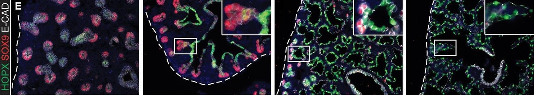 Evolution of alveolar epithelial gene expression patterns in the developing mouse lung. Sections of E15.5, 16.5, 17.5 and 18.5 wild-type mouse lungs stained for markers of differentiation. (A) Green, SOX2 (differentiating bronchioles); red, SOX9 (tips); white, LPCAT1 (tip cells from E16.5, then AT2 cells). (B) Green, CEBPA (sub-set of tip cells from E16.5, then AT2 cells); red, pro-SFTPC (embryonic epithelium, stronger from E16.5, later specific to AT2 cells). (C) Green, pro-SFTPC (stronger from E16.5, later specific to AT2 cells); red, LAMP3 (rare tip cells; AT2 cells); magenta, PDPN (tip cells from E16.5, then AT1 cells). (D) Green, LPCAT1 (tip cells from E16.5, then AT2 cells); red, LAMP3 (rare tip cells; AT2 cells); magenta, PDPN (tip cells from E16.5, then AT1 cells). (E) Green, HOPX (stalk cells from E16.5, AT1 cells); red, SOX9 (tip cells); white, E-CAD (epithelial cells). (F) Green, SOX2 (differentiating bronchioles); red, SOX9 (tips); white, HOPX (stalk cells from E16.5, AT1 cells). (G) Green, HOPX (stalk cells from E16.5, AT1 cells); red, LPCAT1 (tip cells from E16.5, then AT2 cells). Arrows, LPCAT1+ HOPX+ cells; arrowheads, LPCAT1+ HOPX− cells. Blue, DAPI (nuclei). Dashed line, edge of lung. Scale bars: 50 μm in A-F, 20 μm in G and insets. Image collected and cropped by CiteAb from the following publication (//pubmed.ncbi.nlm.nih.gov/27578791), licensed under a CC-BY license. Not internally tested by R&D Systems.