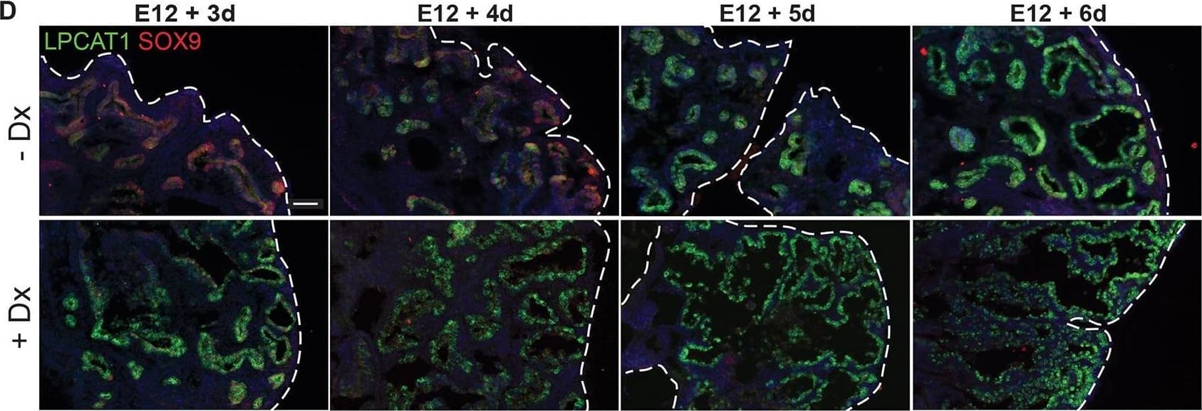 Glucocorticoid signalling is sufficient, but not essential, to specify alveolar fate. (A) Experimental design: Tomato+ E12.5 or 16.5 tip or stalk was grafted into E12.5 host lung and grown with 50 nM Dx throughout culture. (B) Examples of alveolar-fated tip grafts stained for: green, LPCAT1 (alveolar fate); red, Tomato (graft); white, PDPN (basal and AT1 cells). Arrowheads, PDPN+ AT1 cells. (C) Split bar graph showing results from B. Each type of graft was analysed in at least three independent experiments. (D) E12.5 wild-type lungs were grown with or without Dx for up to 6 days; two independent experimental replicates. Note precocious expression of alveolar markers in the presence of Dx. Lungs cultured without Dx do express LPCAT1 from experimental day 5. Green, LPCAT1 (late tip progenitors and type 2 cells); red, SOX9 (tip progenitors). (E,F) Sections of GR−/− and GR+/+ sibling lungs at E17.5 and E18.5 stained for: green, HOPX (AT1 cells); red, SOX9 (tip progenitors); white, E-CAD (epithelium) (E), and: green, LPCAT1 (late tip progenitors and AT2 cells); red, LAMP3 (AT2 cells); magenta, PDPN (late tip progenitors and AT1 cells) (F). A total of five GR−/− and 5 GR+/+ sibling lungs from three independent litters were observed at both E17.5 and E18.5. Blue, DAPI. Dashed line, edge of lung. Scale bars: 100 μm in B; 50 μm in D-F. Image collected and cropped by CiteAb from the following publication (//pubmed.ncbi.nlm.nih.gov/27578791), licensed under a CC-BY license. Not internally tested by R&D Systems.