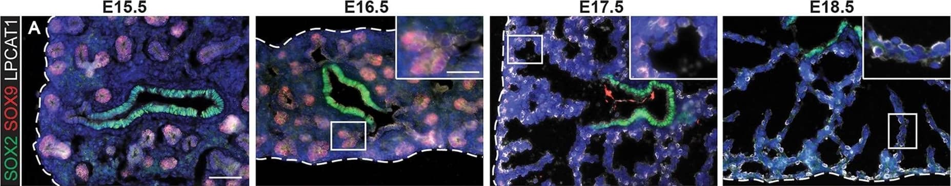 Evolution of alveolar epithelial gene expression patterns in the developing mouse lung. Sections of E15.5, 16.5, 17.5 and 18.5 wild-type mouse lungs stained for markers of differentiation. (A) Green, SOX2 (differentiating bronchioles); red, SOX9 (tips); white, LPCAT1 (tip cells from E16.5, then AT2 cells). (B) Green, CEBPA (sub-set of tip cells from E16.5, then AT2 cells); red, pro-SFTPC (embryonic epithelium, stronger from E16.5, later specific to AT2 cells). (C) Green, pro-SFTPC (stronger from E16.5, later specific to AT2 cells); red, LAMP3 (rare tip cells; AT2 cells); magenta, PDPN (tip cells from E16.5, then AT1 cells). (D) Green, LPCAT1 (tip cells from E16.5, then AT2 cells); red, LAMP3 (rare tip cells; AT2 cells); magenta, PDPN (tip cells from E16.5, then AT1 cells). (E) Green, HOPX (stalk cells from E16.5, AT1 cells); red, SOX9 (tip cells); white, E-CAD (epithelial cells). (F) Green, SOX2 (differentiating bronchioles); red, SOX9 (tips); white, HOPX (stalk cells from E16.5, AT1 cells). (G) Green, HOPX (stalk cells from E16.5, AT1 cells); red, LPCAT1 (tip cells from E16.5, then AT2 cells). Arrows, LPCAT1+ HOPX+ cells; arrowheads, LPCAT1+ HOPX− cells. Blue, DAPI (nuclei). Dashed line, edge of lung. Scale bars: 50 μm in A-F, 20 μm in G and insets. Image collected and cropped by CiteAb from the following publication (//pubmed.ncbi.nlm.nih.gov/27578791), licensed under a CC-BY license. Not internally tested by R&D Systems.