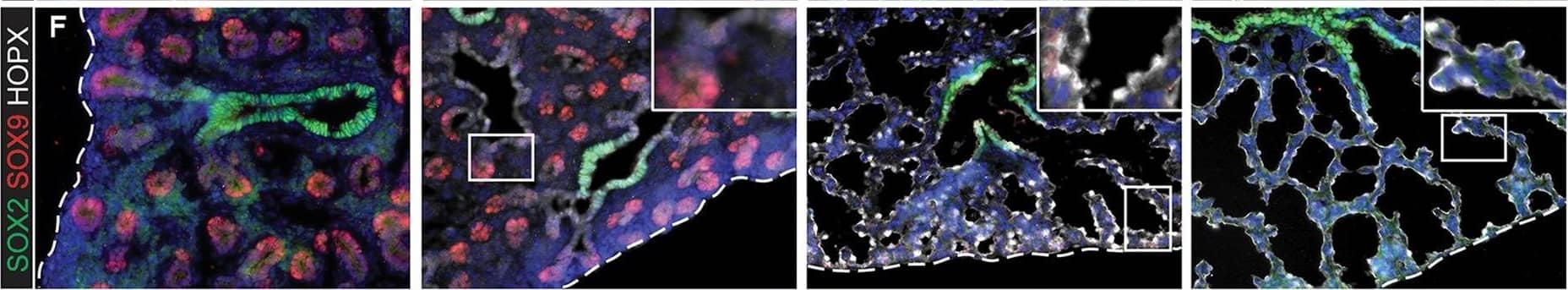 Evolution of alveolar epithelial gene expression patterns in the developing mouse lung. Sections of E15.5, 16.5, 17.5 and 18.5 wild-type mouse lungs stained for markers of differentiation. (A) Green, SOX2 (differentiating bronchioles); red, SOX9 (tips); white, LPCAT1 (tip cells from E16.5, then AT2 cells). (B) Green, CEBPA (sub-set of tip cells from E16.5, then AT2 cells); red, pro-SFTPC (embryonic epithelium, stronger from E16.5, later specific to AT2 cells). (C) Green, pro-SFTPC (stronger from E16.5, later specific to AT2 cells); red, LAMP3 (rare tip cells; AT2 cells); magenta, PDPN (tip cells from E16.5, then AT1 cells). (D) Green, LPCAT1 (tip cells from E16.5, then AT2 cells); red, LAMP3 (rare tip cells; AT2 cells); magenta, PDPN (tip cells from E16.5, then AT1 cells). (E) Green, HOPX (stalk cells from E16.5, AT1 cells); red, SOX9 (tip cells); white, E-CAD (epithelial cells). (F) Green, SOX2 (differentiating bronchioles); red, SOX9 (tips); white, HOPX (stalk cells from E16.5, AT1 cells). (G) Green, HOPX (stalk cells from E16.5, AT1 cells); red, LPCAT1 (tip cells from E16.5, then AT2 cells). Arrows, LPCAT1+ HOPX+ cells; arrowheads, LPCAT1+ HOPX− cells. Blue, DAPI (nuclei). Dashed line, edge of lung. Scale bars: 50 μm in A-F, 20 μm in G and insets. Image collected and cropped by CiteAb from the following publication (//pubmed.ncbi.nlm.nih.gov/27578791), licensed under a CC-BY license. Not internally tested by R&D Systems.