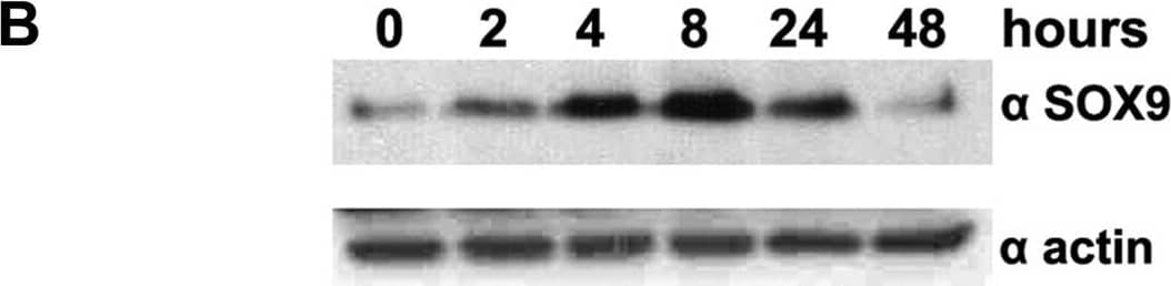 Validation of stem cell associated proteins after HGF stimulation.A, FACS demonstrated up-regulation of CD49b (240%), CD49f (22%), CD44 (26%), together with down-regulation of CD24 (−69%) after HGF stimulation. Thin gray line represents labelling with secondary antibody only (negative control), thin black line DU145 without HGF, and thick black line DU145 with HGF. B, Western blot showed enhancement of SOX9 expression upon HGF stimulation from 2 to 24 hours. C, FACS demonstrated induction of double-labelled CD44+/CD24− DU145 cells (control 8% versus HGF 26%). Image collected and cropped by CiteAb from the following open publication (//pubmed.ncbi.nlm.nih.gov/22110593), licensed under a CC-BY license. Not internally tested by R&D Systems.