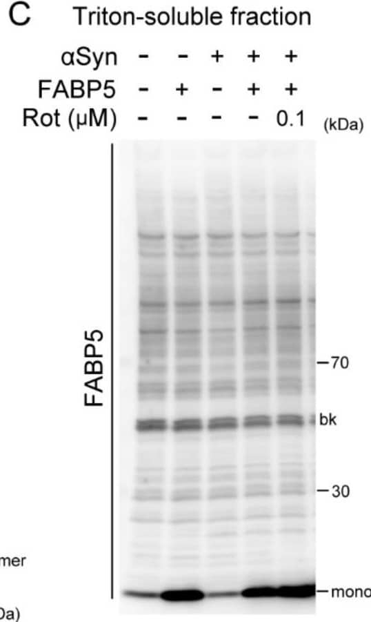 Effects of rotenone on  alpha Syn oligomerization and aggregation in FABP5/ alpha Syn-transfected Neuro-2A cells. (A–D) Representative images of immunoblots probed with antibodies against  alpha Syn and FABP5 under non-denaturing conditions of Triton-soluble and SDS-soluble fractions. Detection with anti-beta -tubulin antibody was used as a protein-loading control. (E–G) Quantitative analyses of protein contents of different molecular weights, which indicate protein complexes of dimer/trimers, oligomers, and aggregates. Results are presented as means ± SEM (n = 3 respective cell experiments). * p < 0.05, ** p < 0.01, vs. 0.1 μM rotenone-treated  alpha S/F5 cells. n.s., not statistically significant. D/T: dimers/trimers; O: oligomers; A: aggregates. bk besides blots indicate non-specific bands. Image collected and cropped by CiteAb from the following open publication (//pubmed.ncbi.nlm.nih.gov/33499263), licensed under a CC-BY license. Not internally tested by R&D Systems.