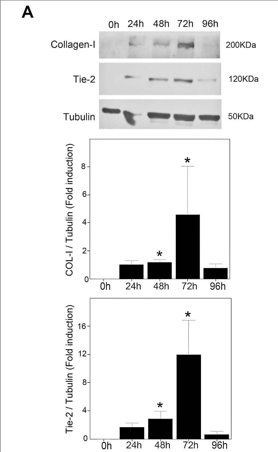 Activation of HSC increases Tie2 expression.(A) Kinetics of Tie2 expression during in vitro activation of HSC. HSC, plated at 50,000 cells/cm2 density and grown in 2% DMEM during 24, 48, 72 and 96 hours, were lysed in Laemmli buffer and loaded in 7% acrylamide gels (20 µL of total protein extract per well). SDS-PAGE resolved proteins were transferred to nitrocellulose membranes and probed with respective antibodies against COL-I (H-197, 1∶2000), Tie2 (AF313, 1∶200) or tubulin (DM1A, 1∶5000). Quantitative analysis of Tie2 or COL-1 chemiluminescence in relation to tubulin (FUJIFILM Science Lab Image Gauge) is shown in respective graphs. *p<0.05 versus 24 h (mean +SD, 3 independent experiments). Image collected and cropped by CiteAb from the following open publication (//pubmed.ncbi.nlm.nih.gov/25302785), licensed under a CC-BY license. Not internally tested by R&D Systems.