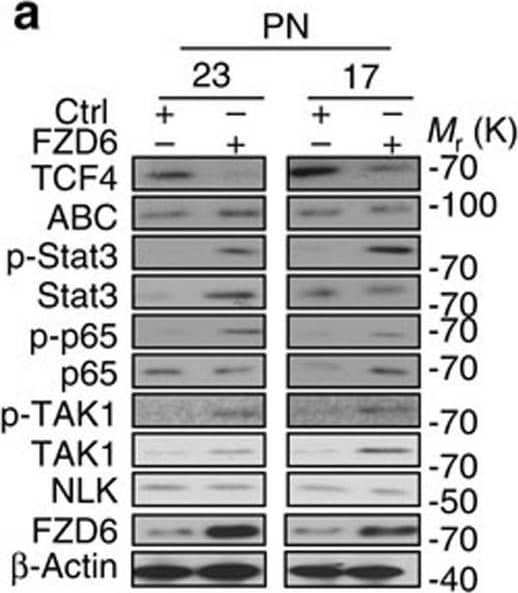 FZD6 mediates induction of the MES-associated phenotype and suppression of the Wnt signalling through TAK1.(a) IB analysis on PN 23 and 17 spheres with or without FZD6 overexpression using indicated antibodies. (b) qRT–PCR analysis of PN-associated genes OLIG2 and SOX2, and MES-associated genes ALDH1A3 and CD44 in PN 23 spheres with or without FZD6 overexpression. (c) FZD6 expression promoted PN 23 spheres proliferation and self-renewal. (d) Ectopic expression of FZD6 promoted tumour growth of PN 23 spheres in GBM xenografts in the brain (n=5). Scale bar, 1.0 mm. (e) TOPFlash/FOPFlash assays on PN 23 with overexpressing FZD6 or control, with or without CaMKII inhibitor KN93 (5 μM), TAK1 inhibitor 5Z-7-oxo (5 μM), or a shRNA-NLK. (f,g) qRT–PCR analyses of the relative expression of miR-20b and miR-125b (f), and Wnt signalling target gene LEF1 (g) in PN 23 overexpressing FZD6, or a vector control, with or without CaMKII inhibitor KN93 (5 μM), TAK1 inhibitor 5Z-7-oxo (5 μM), or a shRNA-NLK. (h) sphere formation assays for PN 23 and 17 spheres with or without overexpression of FZD1, FZD3, and FZD5, respectively. (i) Summary of data shown in Supplementary Fig. 10. An overview of transmembrane receptors and Wnt ligands that affect FZD6 overexpression-induced phenotypes. Data were normalized to the control. *Relative inhibitory effects on indicated protein expression or cellular properties. Error bars (s.d.) represent the data of triplicate samples for each cell line or tumours from five individual mice in each group. *P<0.05, **P<0.01, paired two-way Student's t-test. Data are representative from three independent experiments with similar results. Image collected and cropped by CiteAb from the following open publication (//pubmed.ncbi.nlm.nih.gov/27698350), licensed under a CC-BY license. Not internally tested by R&D Systems.