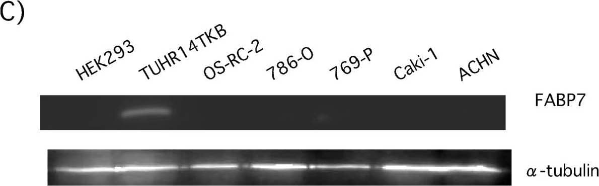 Western Blot FABP7/B-FABP Antibody [Unconjugated]