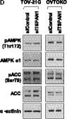 TSPAN1 knockdown decreases cell proliferation in OCCC cell lines. (A) TSPAN1 expression was detected by real‐time PCR (left panel) and immunoblotting (right panel) in TOV‐21G and OVTOKO cells, with  alpha ‐actinin as an internal loading control. Data are expressed as the mean ± standard error (SE); n = 3. Unpaired t‐test was performed. *P < 0.05, **P < 0.01. (B) Cell proliferation was determined via crystal violet staining at various times after transient transfection of siControl or siTSPAN1 in TOV‐21G and OVTOKO cells. Error bars represent mean ± SE; n = 3. Unpaired t‐test was performed. **P < 0.01, ***P < 0.001. (C) Colony forming assay was performed in TOV‐21G and OVTOKO cells. Upper panel shows representative images; lower panel shows the relative absorbance at 595 nm. Error bars represent mean ± SE; n = 3. Unpaired t‐test was performed. **P < 0.01, ***P < 0.001. (D) Protein expressions were detected using immunoblotting after transient transfection of siControl or siTSPAN1 in TOV‐21G and OVTOKO cells, with  alpha ‐actinin as an internal loading control. Image collected and cropped by CiteAb from the following open publication (//pubmed.ncbi.nlm.nih.gov/33331115), licensed under a CC-BY license. Not internally tested by R&D Systems.